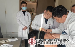 银屑病患者能吃人参吗？补品选择需谨慎