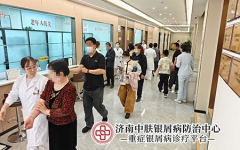 银屑病瘙痒用什么药膏 科学选品避开刺激雷区