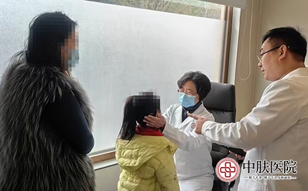 济南哪个银屑病医院专业-济南中肤银屑病医院