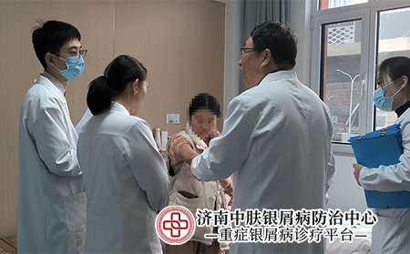 济南银屑病-济南中肤银屑病医院