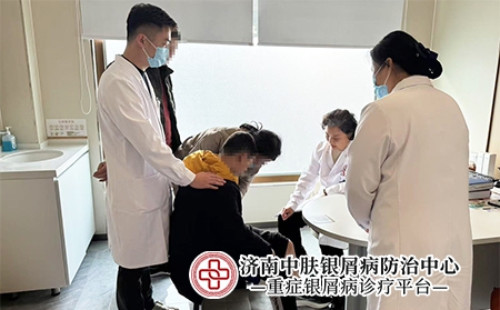 济南银屑病哪里好-济南中肤银屑病医院