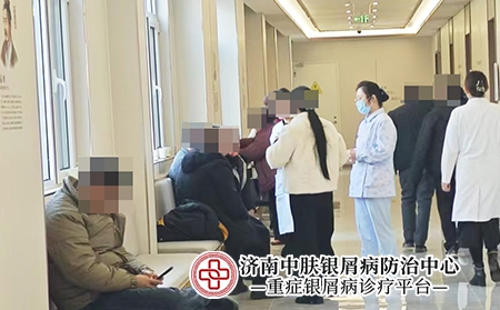济南看银屑病的医院-济南中肤银屑病医院