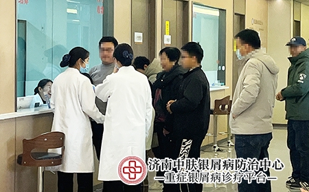 山东济南银屑病医院-济南中肤银屑病医院 山东济南银屑病医院-济南中肤银屑病医院