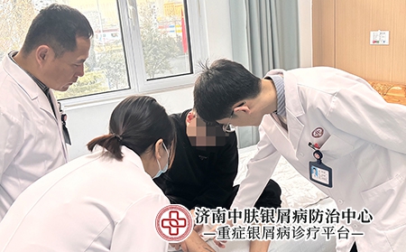 济南银屑病医院怎么样-济南中肤银屑病医院