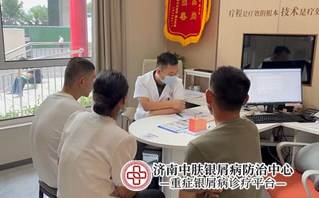 济南张代国寻常型银屑病-济南中肤医院