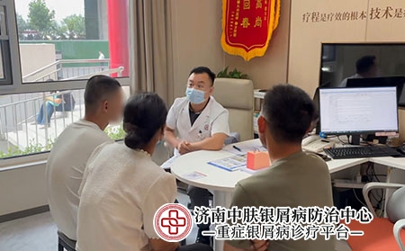济南张代国牛皮癣主任-济南中肤银屑病医院