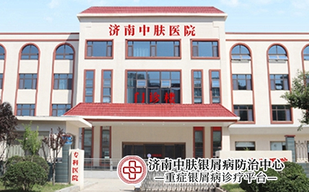 济南专业银屑病医院-济南中肤银屑病医院