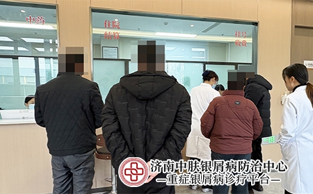 济南牛皮癣皮肤检查 - 济南中肤医院